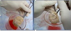 Fertilización In Vitro: cómo se hace