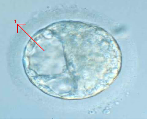 embriones